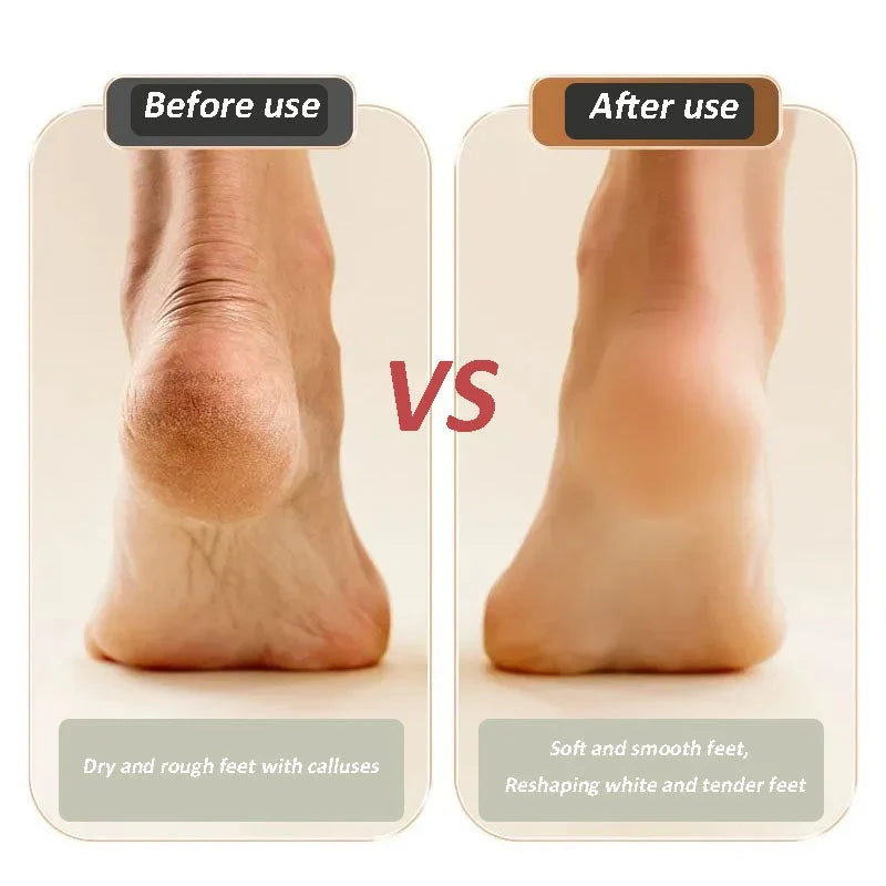 🔥Buy 2 Free Shipping🔥USB Rechargeable Foot Repair and Grinding Device