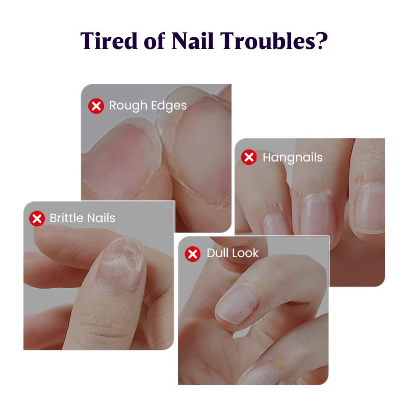 💜Christmas Sale 50% OFF💜2025 New Upgraded 3-in-1 Nail Care Pen💅