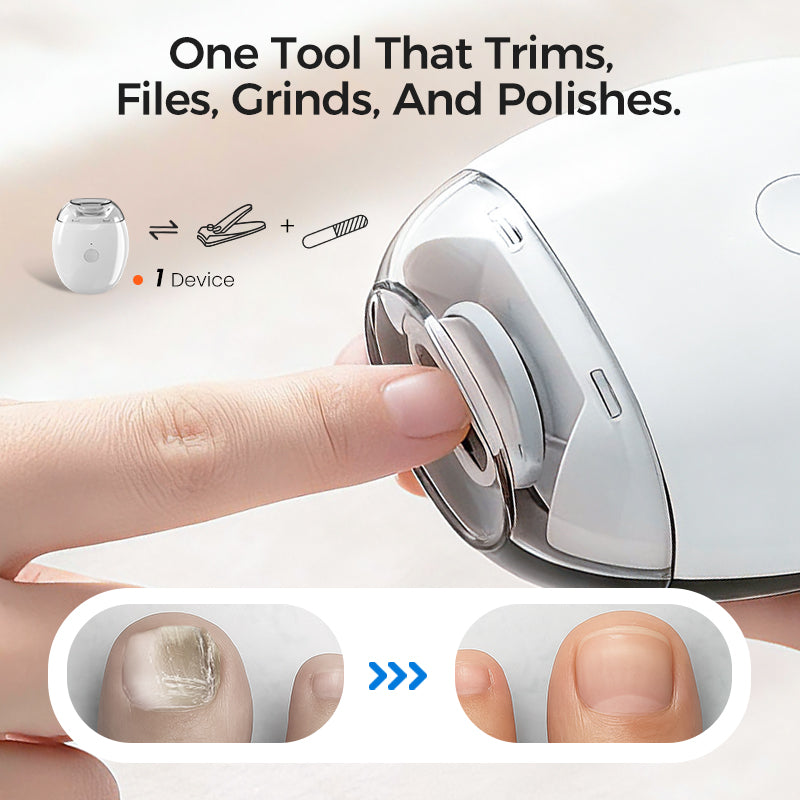🎁Last Day Sale 70% OFF🥳Universal Automatic Fingernail Grinder for Adults and Children🎁