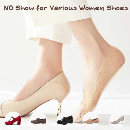 (🎁2024 Hot Sale🎁)🧦 Lace No Show Liner Socks for Women