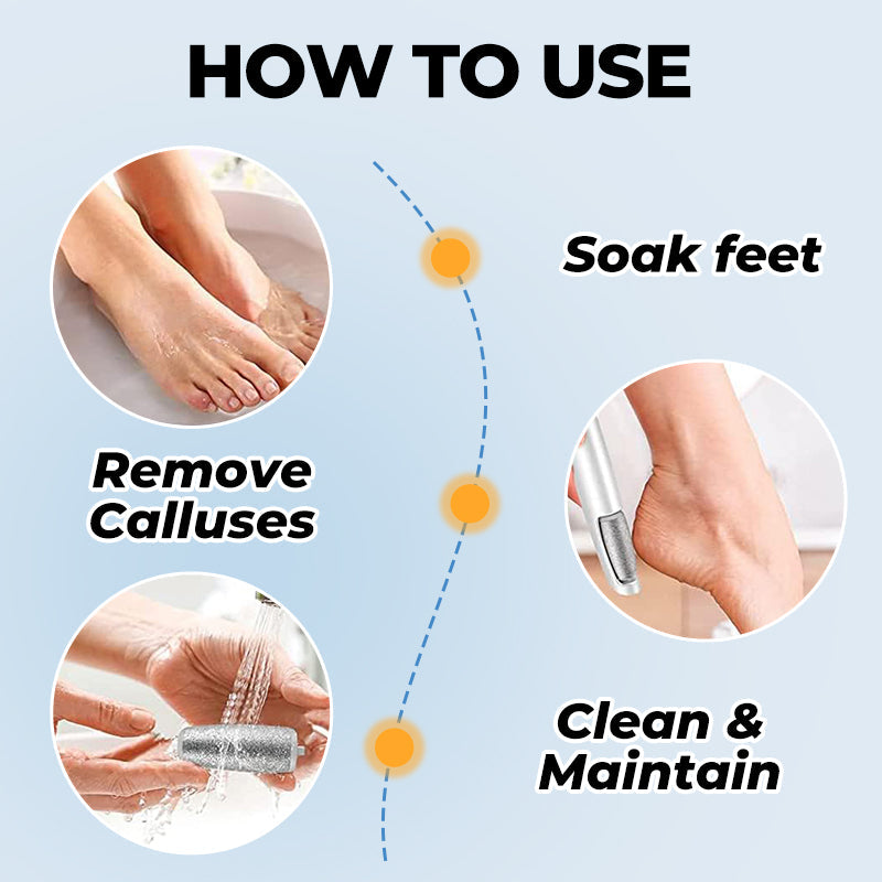 🔥Spring Sale - 50% OFF🔥Electric Feet Callus Remover⚡