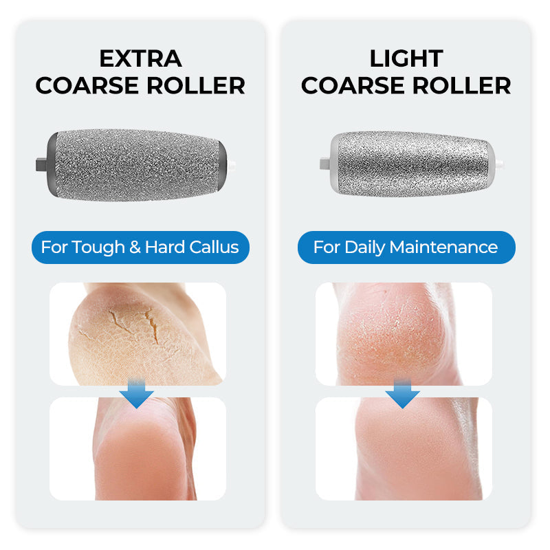 🔥Spring Sale - 50% OFF🔥Electric Feet Callus Remover⚡