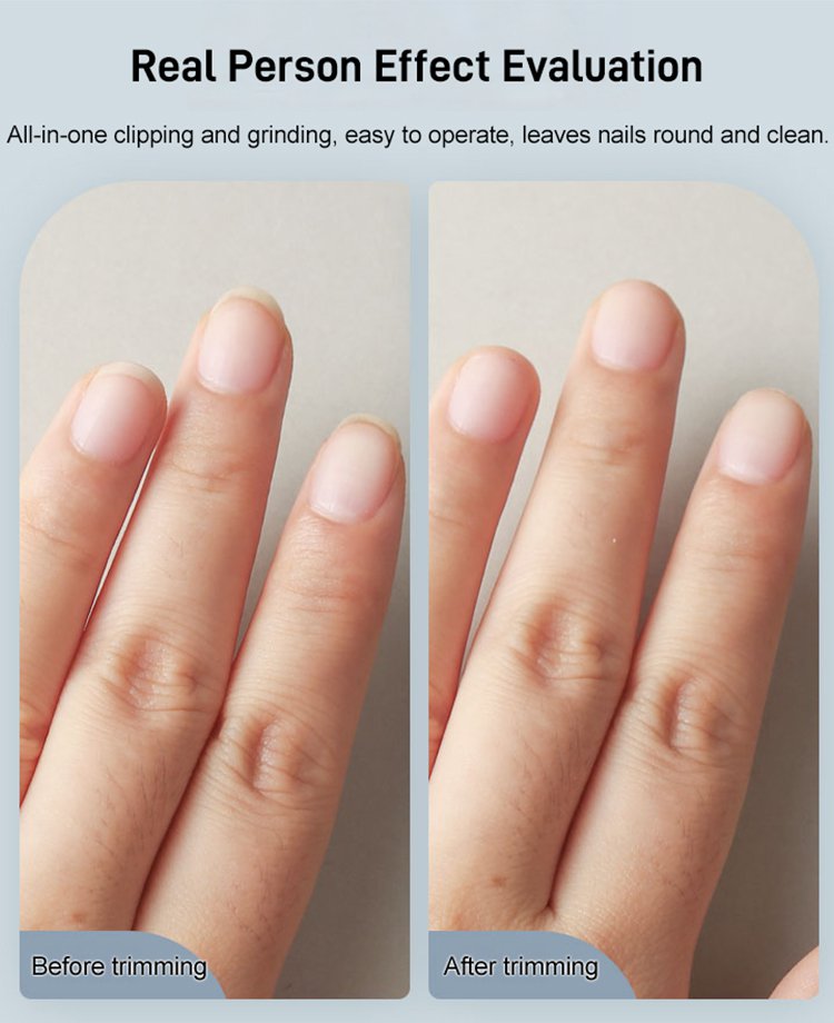 🔥Electric Automatic Nail Clipper