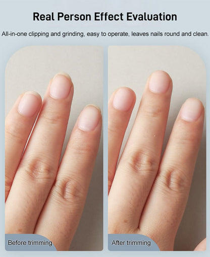 🔥Electric Automatic Nail Clipper