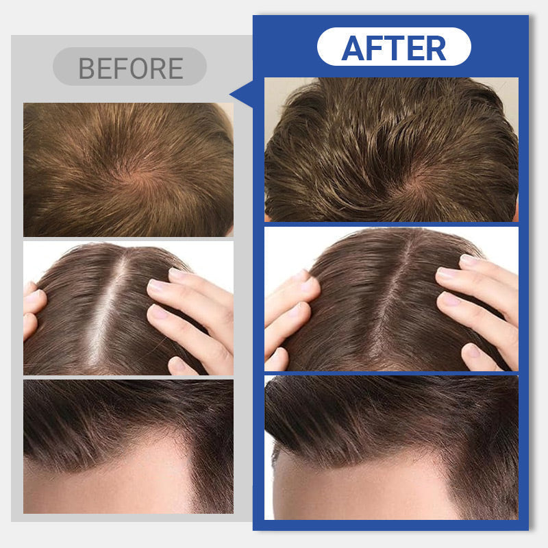 NEW YEAR SALE🤩Hair Building Fibers for Instant Volumizing