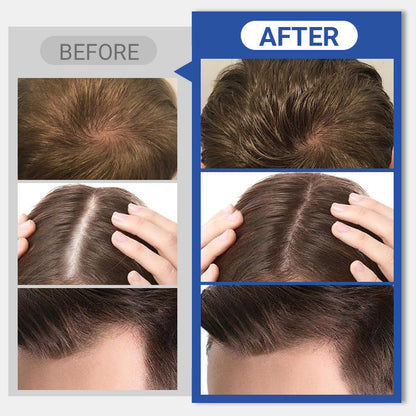 NEW YEAR SALE🤩Hair Building Fibers for Instant Volumizing