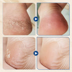 NEW YEAR SALE🤩Hydrating and Anti-Cracking Foot Cream🔥Buy More Save More