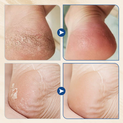 NEW YEAR SALE🤩Hydrating and Anti-Cracking Foot Cream🔥Buy More Save More