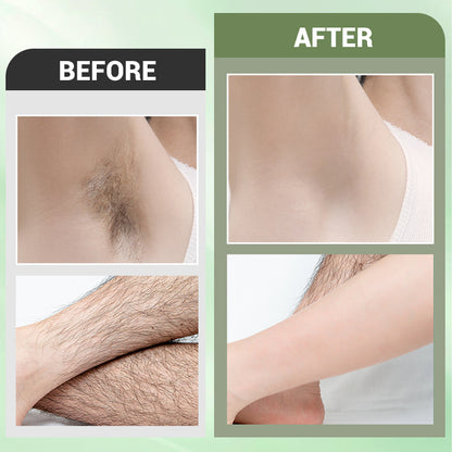 🌸LAST DAY PROMOTION SALE 50% OFF🌸Hair Removal Cream Set for Full Body