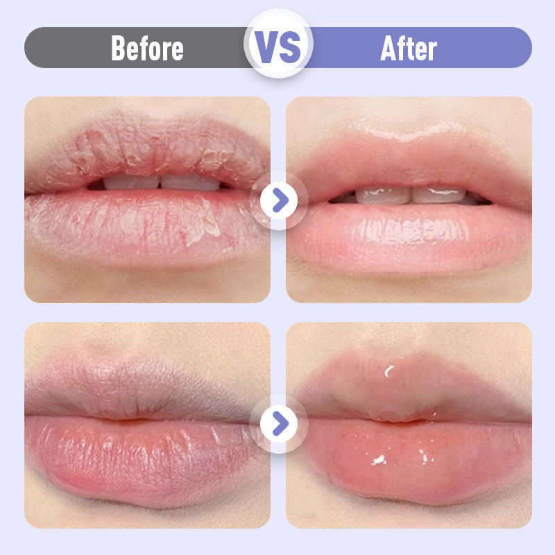 💟Buy 1 Get 1 Free 💟Plumping & Anti-Wrinkle Hydrating Lip Serum