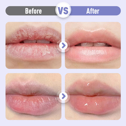 💟Buy 1 Get 1 Free 💟Plumping & Anti-Wrinkle Hydrating Lip Serum