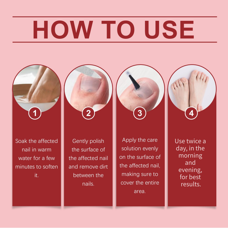 💥Limited-Time Offer:64% OFF!!!💥Nail Repair Essence for Damaged Nails💅🏻