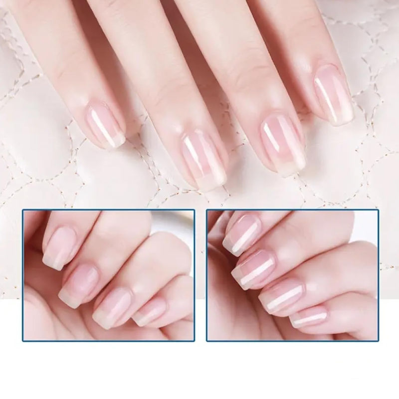 💖LAST DAY - BUY 1 GET 1 FREE!!💕ROZINO 3 Days Nail Care Formula
